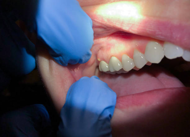Best After-Hours Emergency Dentist in Lyman, MS